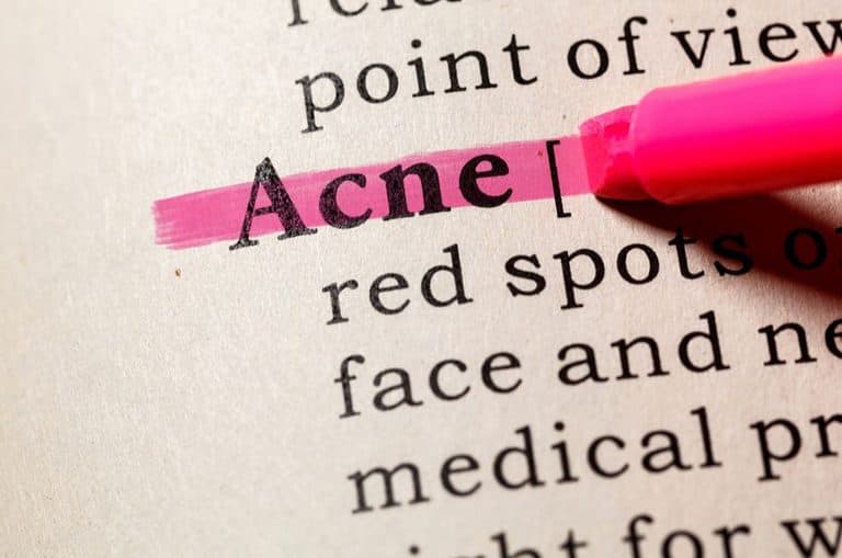 Natural and Effective Solutions To Cure Acne